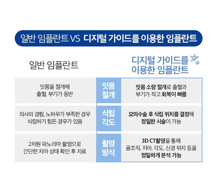 사상맥치과 디지털 가이드를 이용한 임플란트