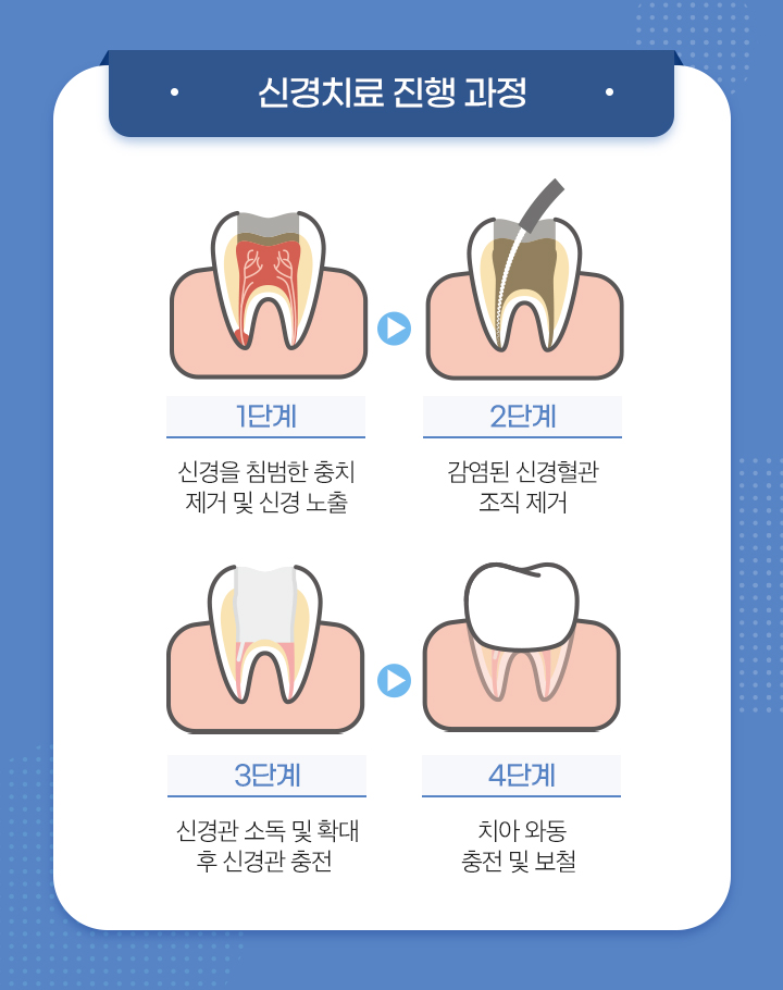 사상맥치과 신경 치료