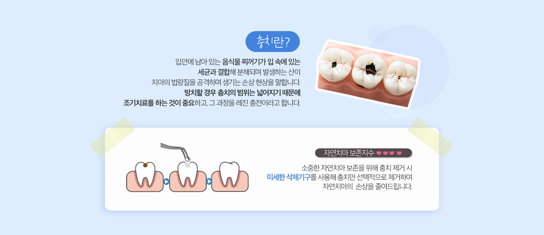 사상맥치과 레진충전