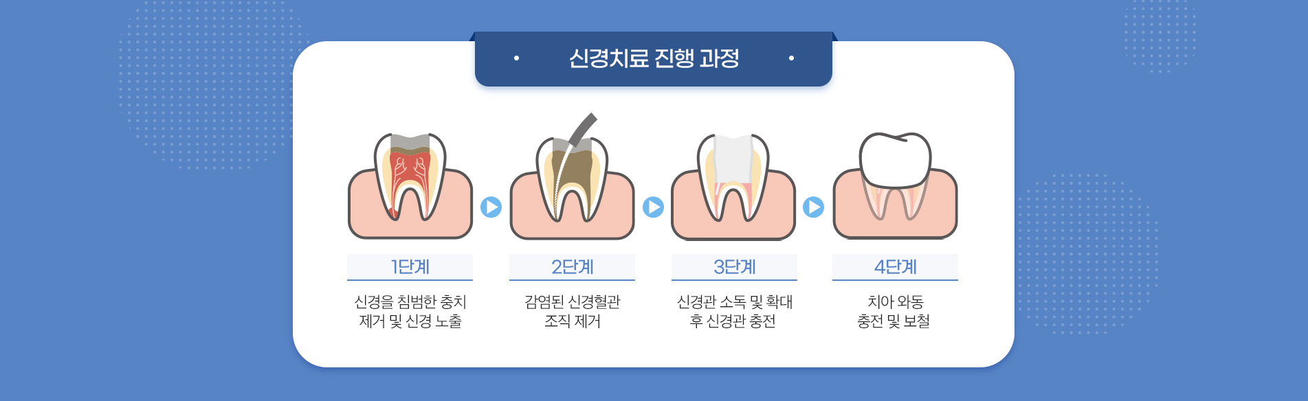 사상맥치과 신경 치료