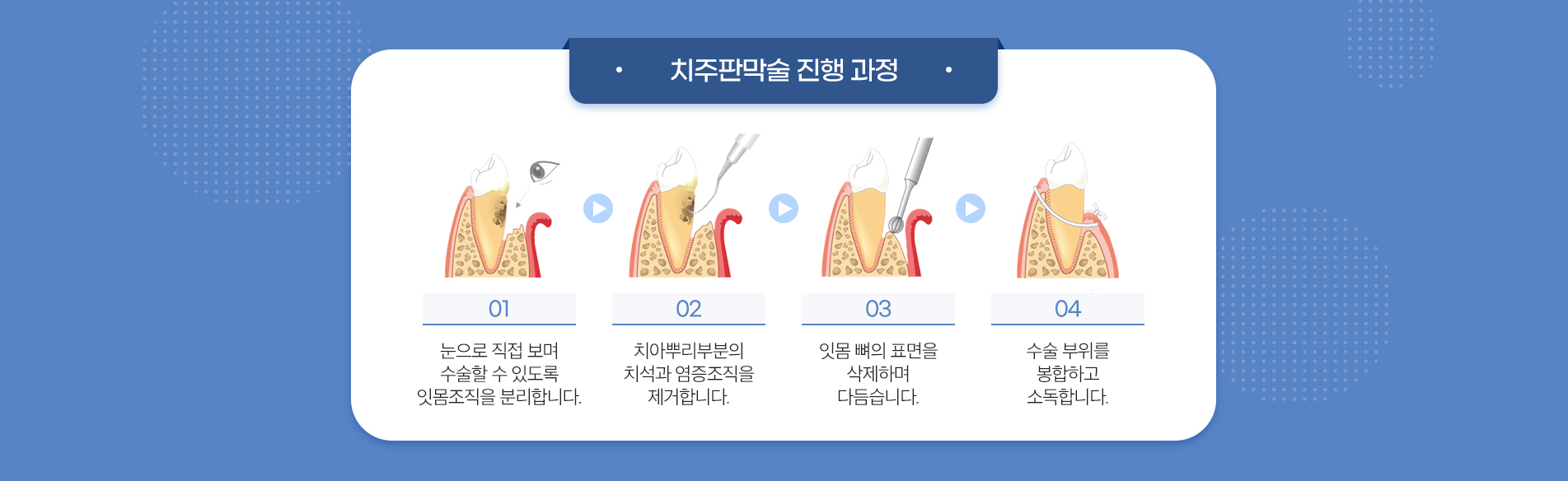 사상맥치과 치주판막술