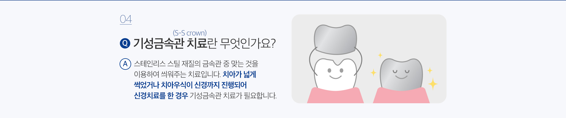 사상맥치과 소아치료