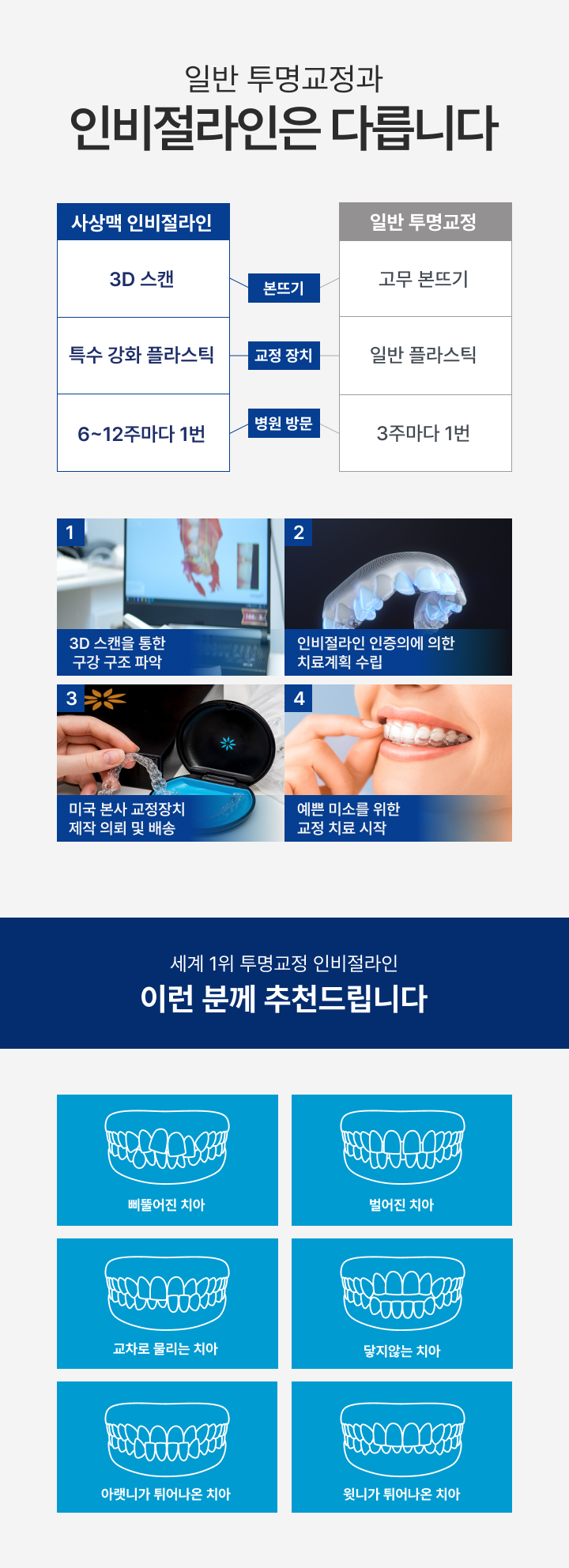 사상맥치과 인비절라인