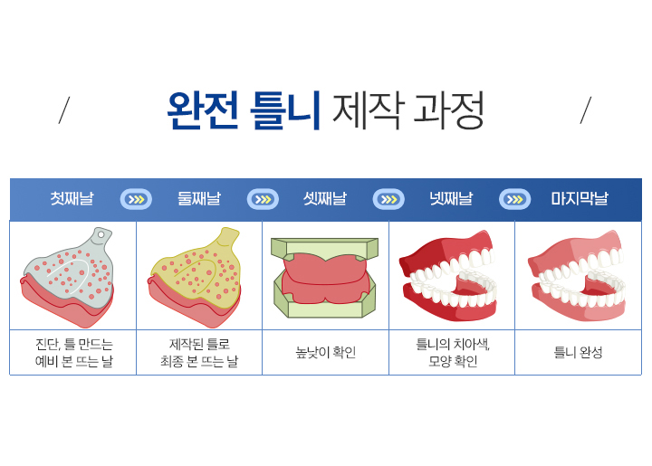 사상맥치과 완전틀니