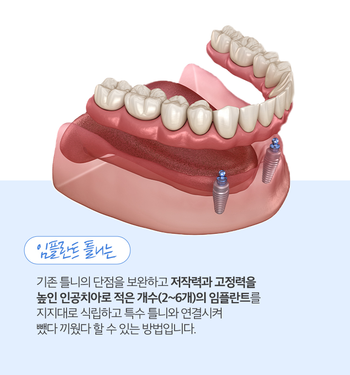 사상맥치과 임플란트 틀니