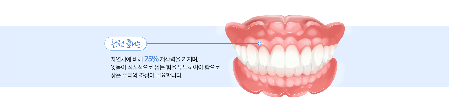 사상맥치과 완전틀니