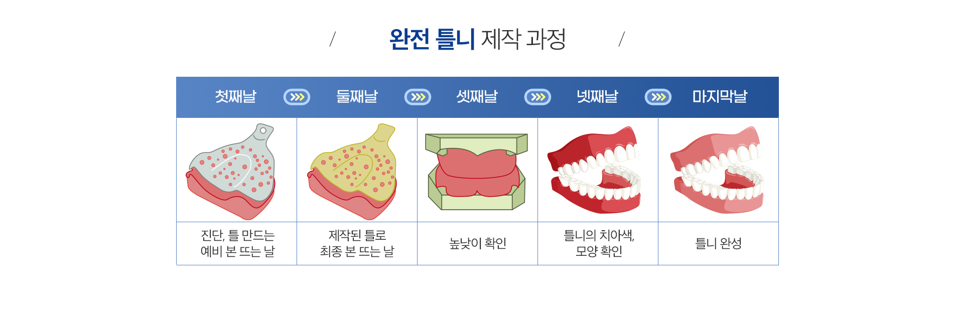 사상맥치과 완전틀니