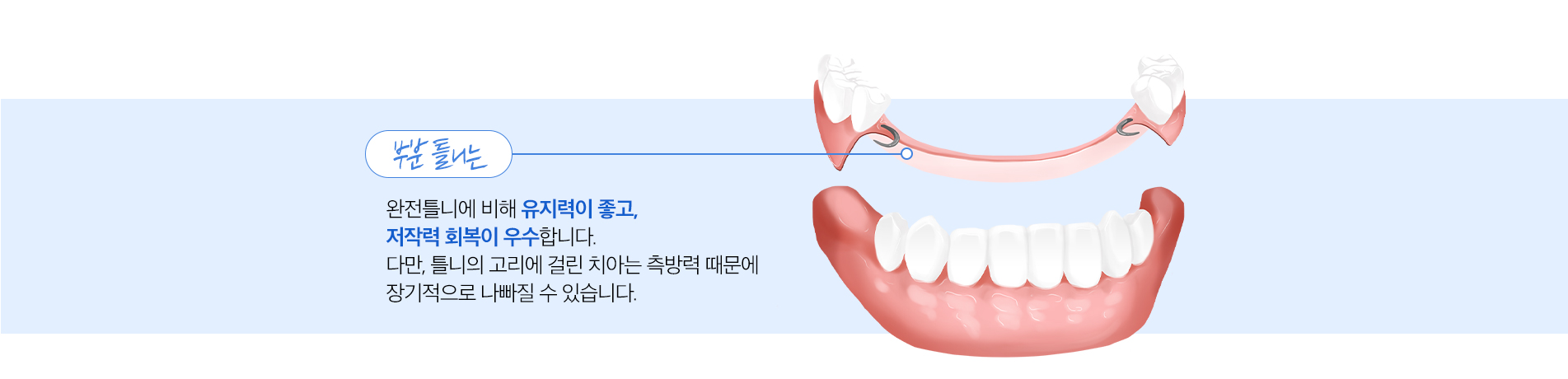 사상맥치과 부분틀니